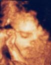 3D Scan of Baby #1