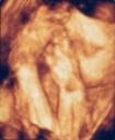 3D Scan of Baby #2