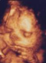 3D Scan of Baby #3