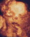3D Scan of Baby #4
